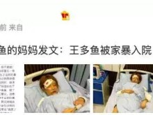 网红女主播王多鱼惨遭家暴住院？网友爆料不是家暴而是出车祸！