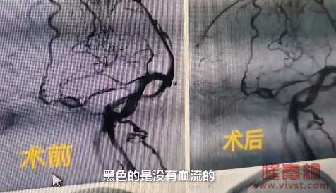广西37岁孕妇纵欲成瘾,送医院抢救:"再舒服,也没有什么比生命更重要!"