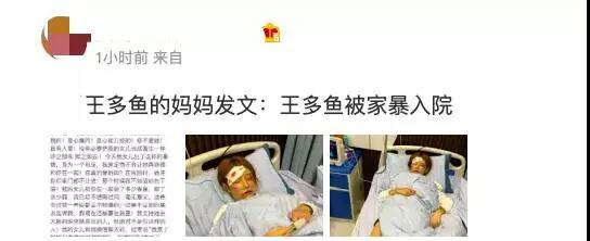 网红女主播王多鱼惨遭家暴住院？网友爆料不是家暴而是出车祸！