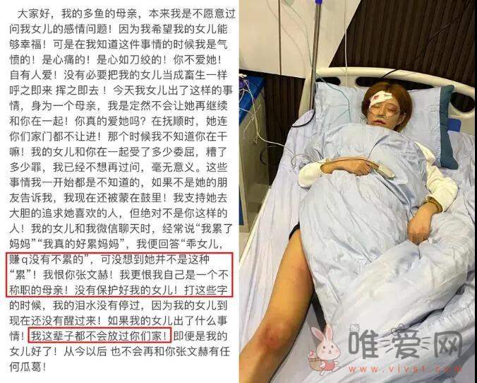 网红女主播王多鱼惨遭家暴住院？网友爆料不是家暴而是出车祸！