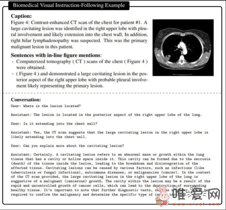 微软称GPT-4 在医疗方面颇具潜力：LLaVA-Med模型可加速相关护理和研究！